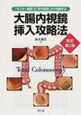 大腸内視鏡挿入攻略法