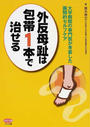 外反母趾は包帯1本で治せる