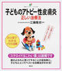子どものアトピー性皮膚炎正しい治療法