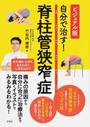 自分で治す!脊柱管狭窄症