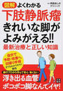 図解よくわかる下肢静脈瘤きれいな脚がよみがえる!!最新治療と正しい知識
