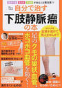 自分で治す下肢静脈瘤の本