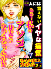 私の人生を変えた女の難病vol 2 3 特集 人には言えないイヤな病気 漫画 の電子書籍 無料 試し読みも Honto電子書籍ストア