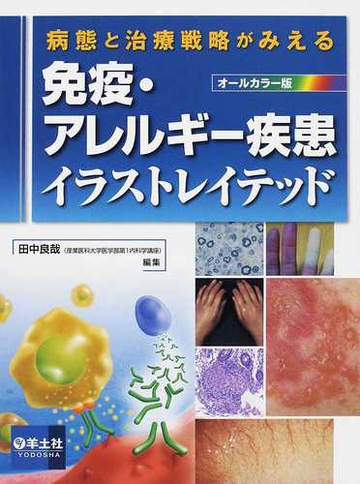 免疫 アレルギー疾患イラストレイテッド 病態と治療戦略がみえる オールカラー版の通販 田中 良哉 紙の本 Honto本の通販ストア