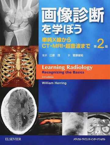 画像診断を学ぼう 単純ｘ線からｃｔ ｍｒｉ 超音波まで 第２版の通販 ウィリアム ヘリング 江原 茂 紙の本 Honto本の通販ストア