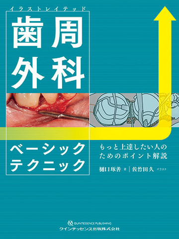 イラストレイテッド歯周外科ベーシックテクニック もっと上達したい人のためのポイント解説の通販 樋口 琢善 佐竹田 久 紙の本 Honto本の通販ストア